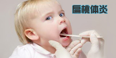 扁桃体炎